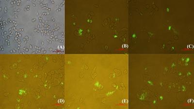 Intracellular behavior of Nocardia seriolae and its apoptotic effect on RAW264.7 macrophages